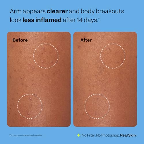 Body Breakout Patches 6 ct Overnight