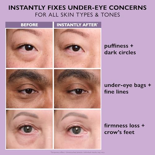 Instant FIRMx® Eye Temporary Eye Tightener Easy-Wear Formula | For Firming Under-Eye Bags