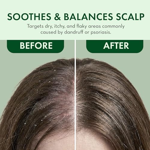 Leave In Conditioner Spray - Rosemary & Mint Scalp T