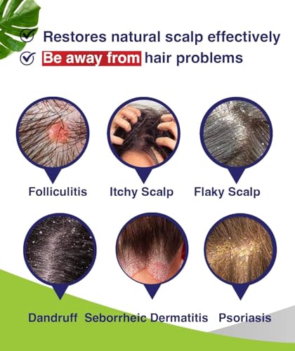 Anti-Fungal Shampoo for Folliculitis, Seborrheic Dermatitis, Scalp Psori