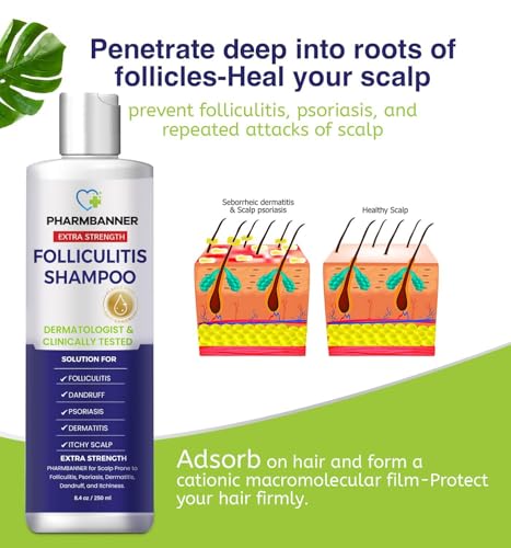 Anti-Fungal Shampoo for Folliculitis, Seborrheic Dermatitis, Scalp Psori