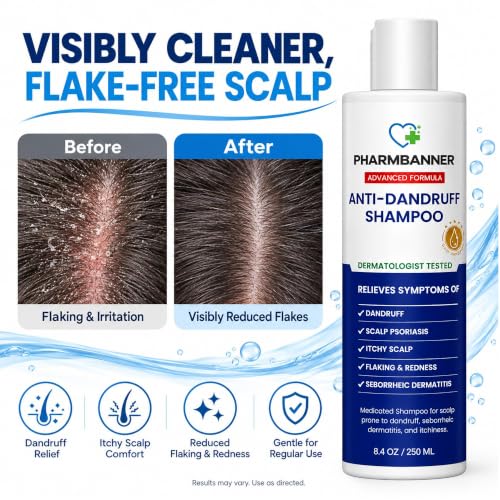 Scalp Psoriasis - Relieves Itchy & Dry Scalp