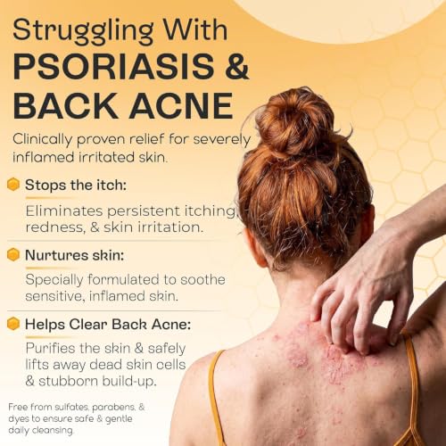 Psoriasis & Antifungal Body Wash with Manuka Honey