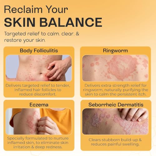 Psoriasis & Antifungal Body Wash with Manuka Honey