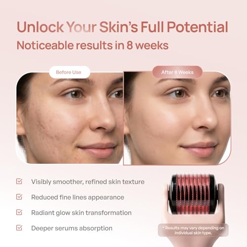 Derma Roller for Hair and Skin