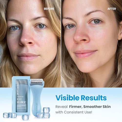 PLANTIFIQUE Ice Roller for Face & Eyes - Reduce Puff