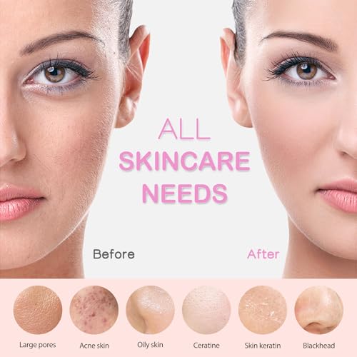 Budget Silicone Cleansing Brush