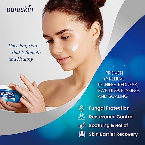 Seborrheic Dermatitis Face Cream: Antifungal Psoriasis Cream - Traditional Herbal Infused
