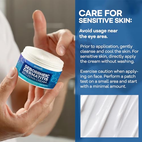 Seborrheic Dermatitis Face Cream: Antifungal Psoriasis Cream - Traditional Herbal Infused