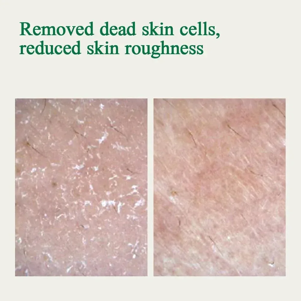 PKY Ultimate Calming Solution Ampoule with Cica & Tea Tree