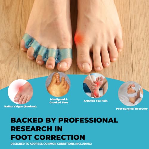 2PCS Toe Spacers & Toe Separators for Women