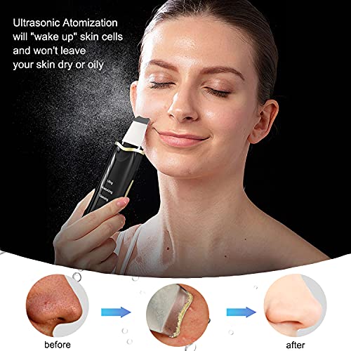Qukot Ultrasonic Skin Scrubber Spatula Blue-Light Blackhead Remover