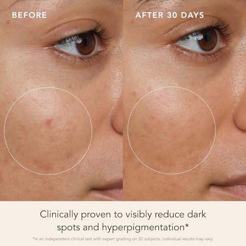 RANAVAT Brightening Saffron Serum - Vitamin C Alternative for Hyperpigmentation & Uneven Skin Tone - Leaves Skin with a Healthy Glow (0.17 oz)