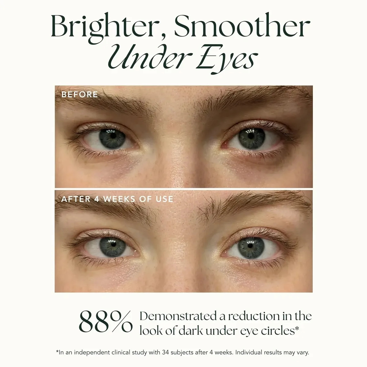 Brightening Retinol Eye Cream - Anti Aging Eye Cream and Dark Circle Corrector