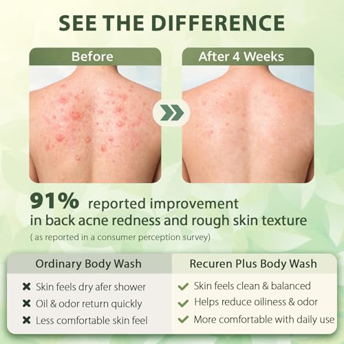 Antifungal Body Wash Soap: Antibacterial