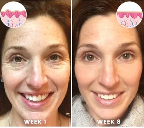 Squalane Vitamin C Rose Serum