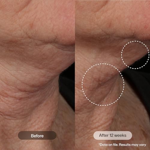 Nectifirm Advanced Neck Cream