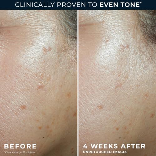 5 in 1 Even Tone + Lift