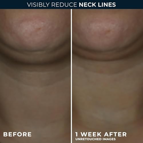 Derm Correxion Neck Cream