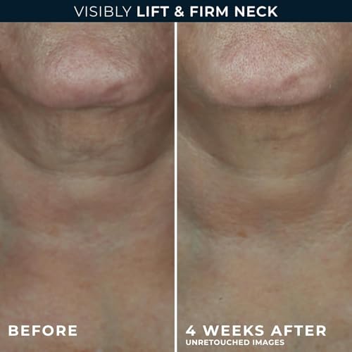 Derm Correxion Neck Cream