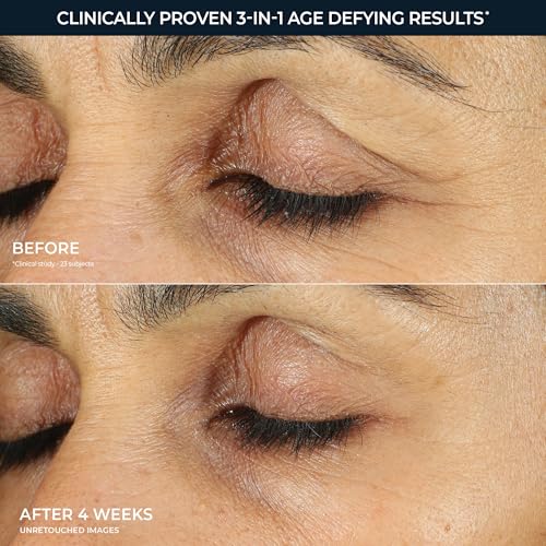 Retinol Correxion Under Eye Cream for Dark Circles & Puffiness