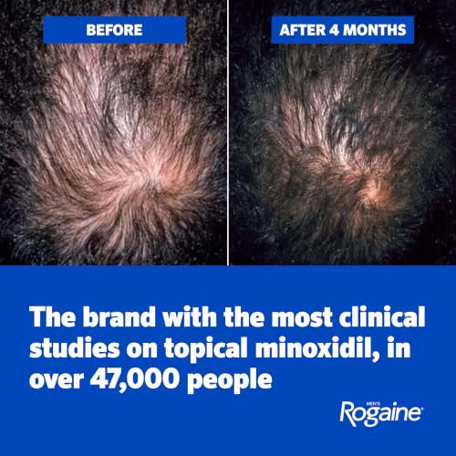 Men's Rogaine Extra Strength 5% Minoxidil Topical Solution