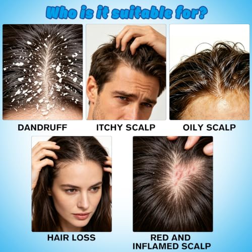 1% Ketoconazole Anti-Dandruff Shampoo