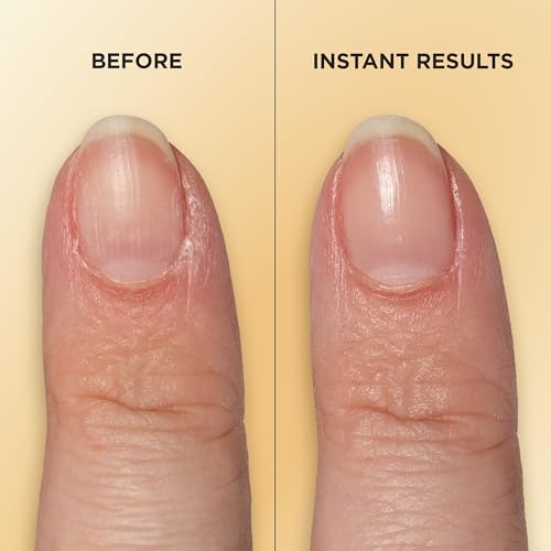 Vitamin E Nail & Cuticle Treatment Pen
