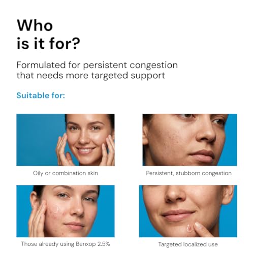 Benxop 5% Benzoyl Peroxide Gel 20g