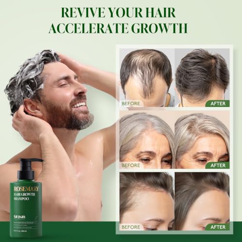 Rosemary Biotin Shampoo for Thinning Hair