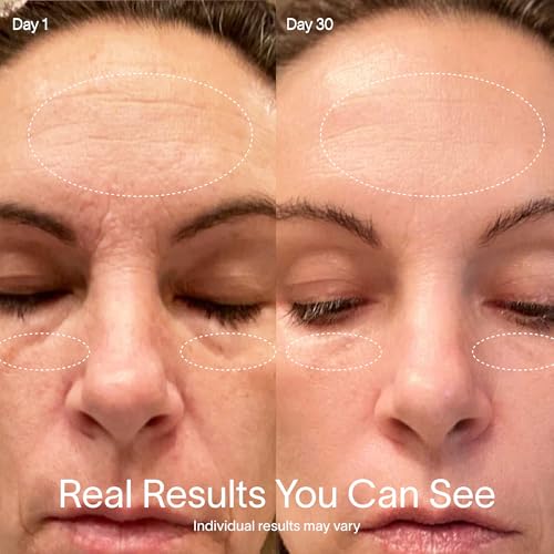4-in-1 Radiant Renewal Red Light Therapy Wand & Renew Complex Activation Serum | Beauty De