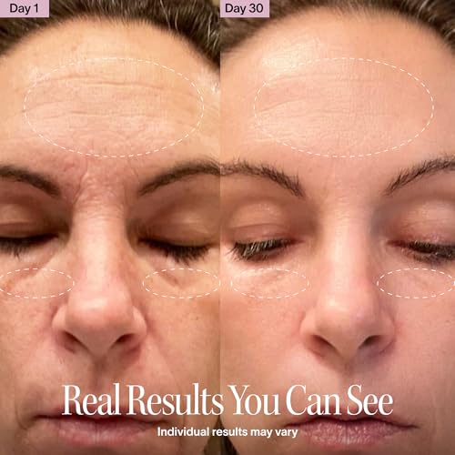 4-in-1 Red Light Therapy Wand for Face & Neck (Rose Gold)