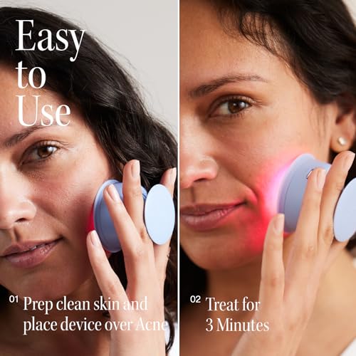 Bye Acne - FDA-Cleared Blue & Red Light Therapy for Face & Body