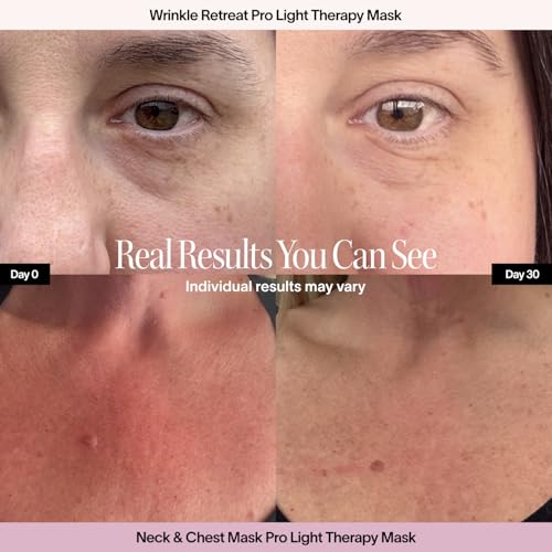 Light Therapy Face Mask & Neck and Chest Mask| Red