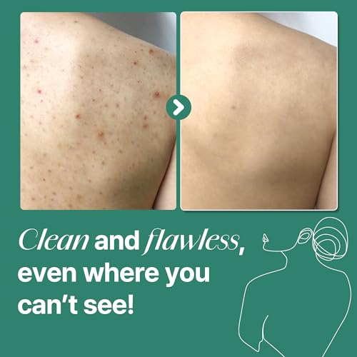 AHA BHA PHA 30 Days Miracle Acne Clear Body Cleanser