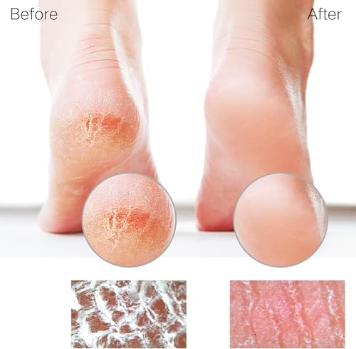 Glass Foot File