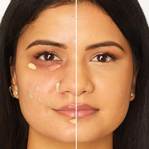 shape tape corrector