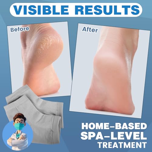 Moisturizing Heel Socks