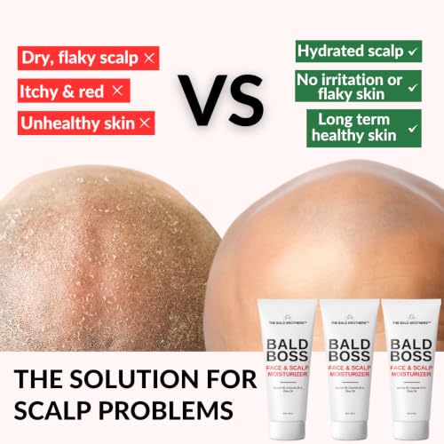 Bald Boss Scalp Moisturizer