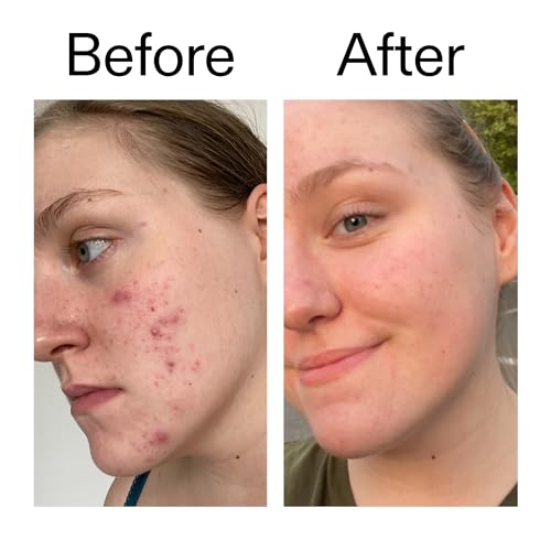 10% Glycolic Acid Toner