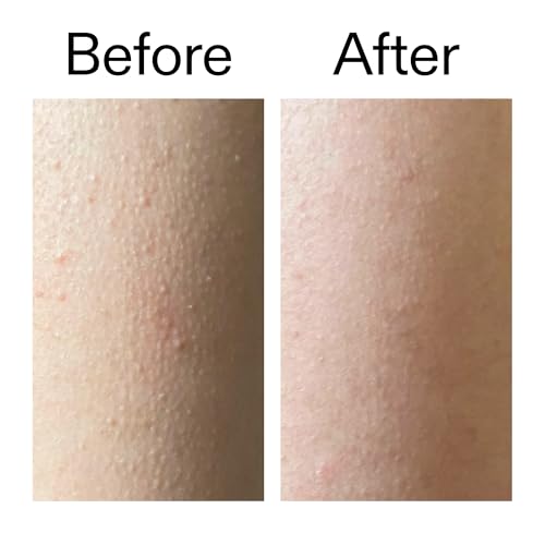 Glycolic Acid Exfoliating Body Stick 45g