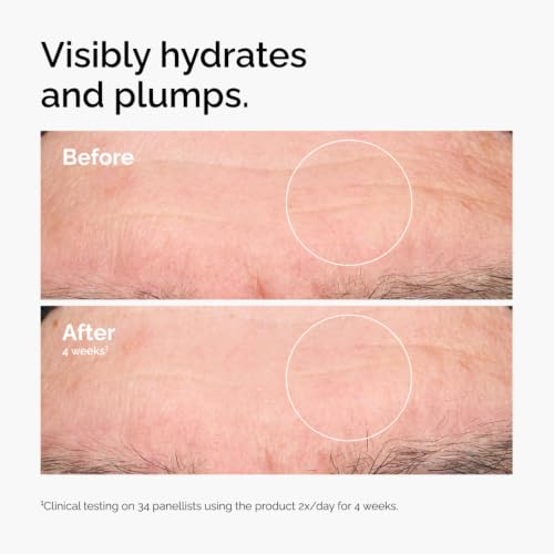Hyaluronic Acid 2% + B5 (with Ceramides)