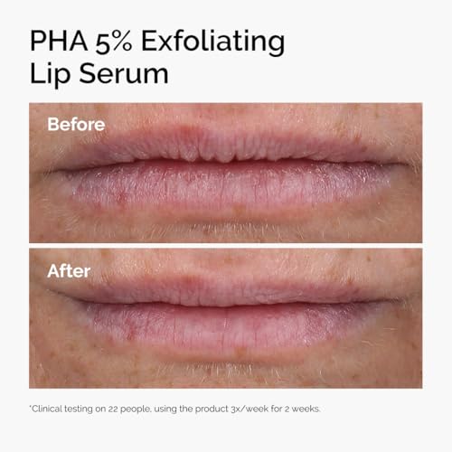 PHA 5% Exfoliating Lip Serum