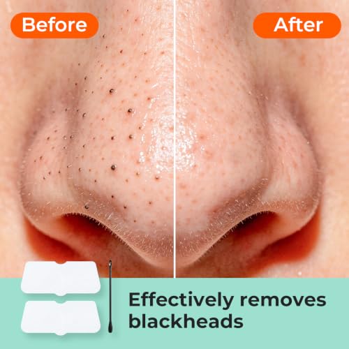 3-Step Melting Blackhead Nose Patches, 8 Pieces