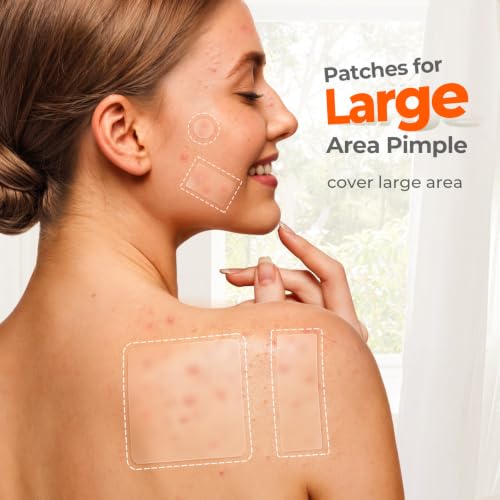 Large Pimple Patches for Face and Body 7 Sizes 126