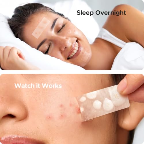 Large Pimple Patches for Face and Body 7 Sizes 126