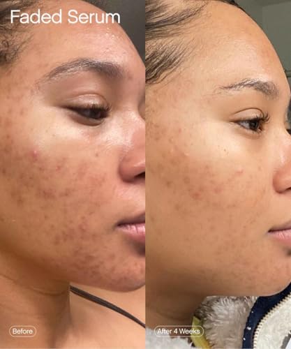 Faded Brightening Serum