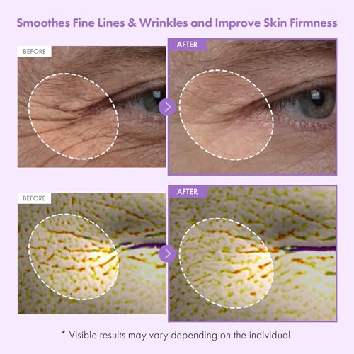 Bakuchiol Capsule Cream, Retinol Alternative, Wrinkles, Firming