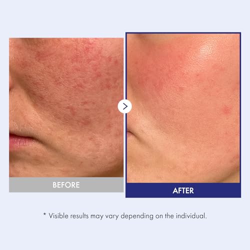 Panthenol 20% Barrier Cream for Soothing