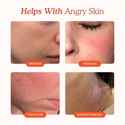 SOS Recovery Hydrating Face Cream